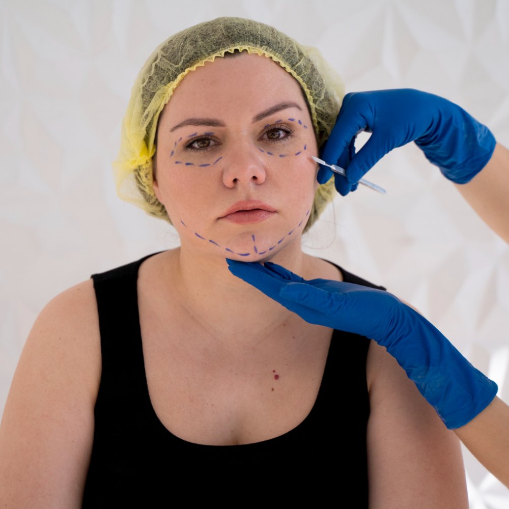 Dermal Fillers aa