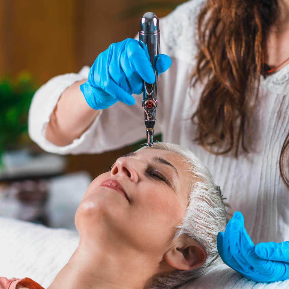 SkinPen Microneedling a